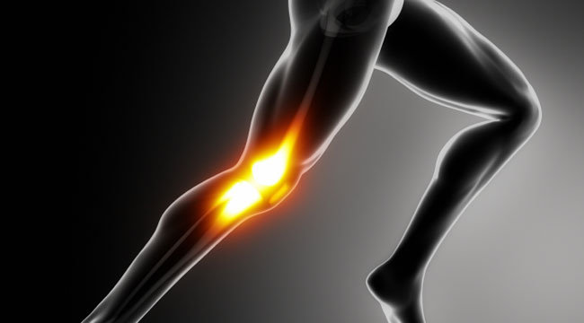 Схематичное изображение боли в колене