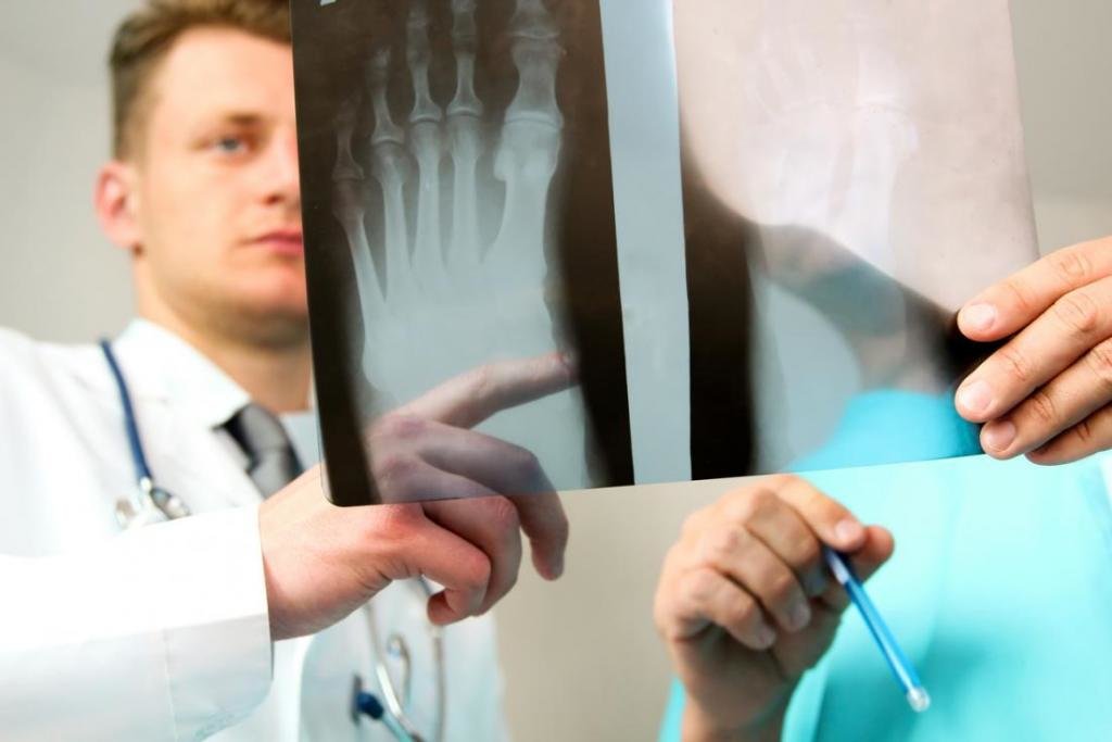 Рентген голеностопного сустава