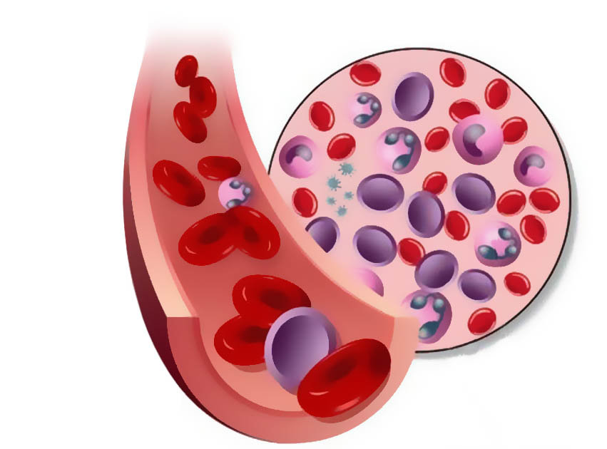 лейкоциты ниже нормы в крови у женщин