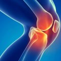 Спортивная травма колена: симптомы, проведение диагностических исследований, диагноз, врачебное наблюдение и лечение